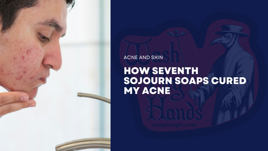 How Seventh Sojourn Soaps Cured My Acne